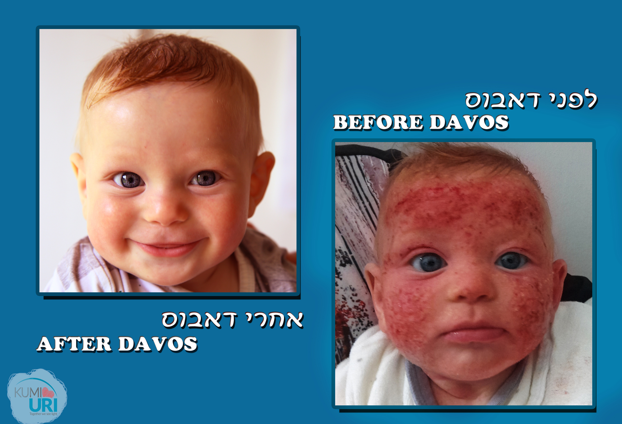 דאבוס 2.jpg