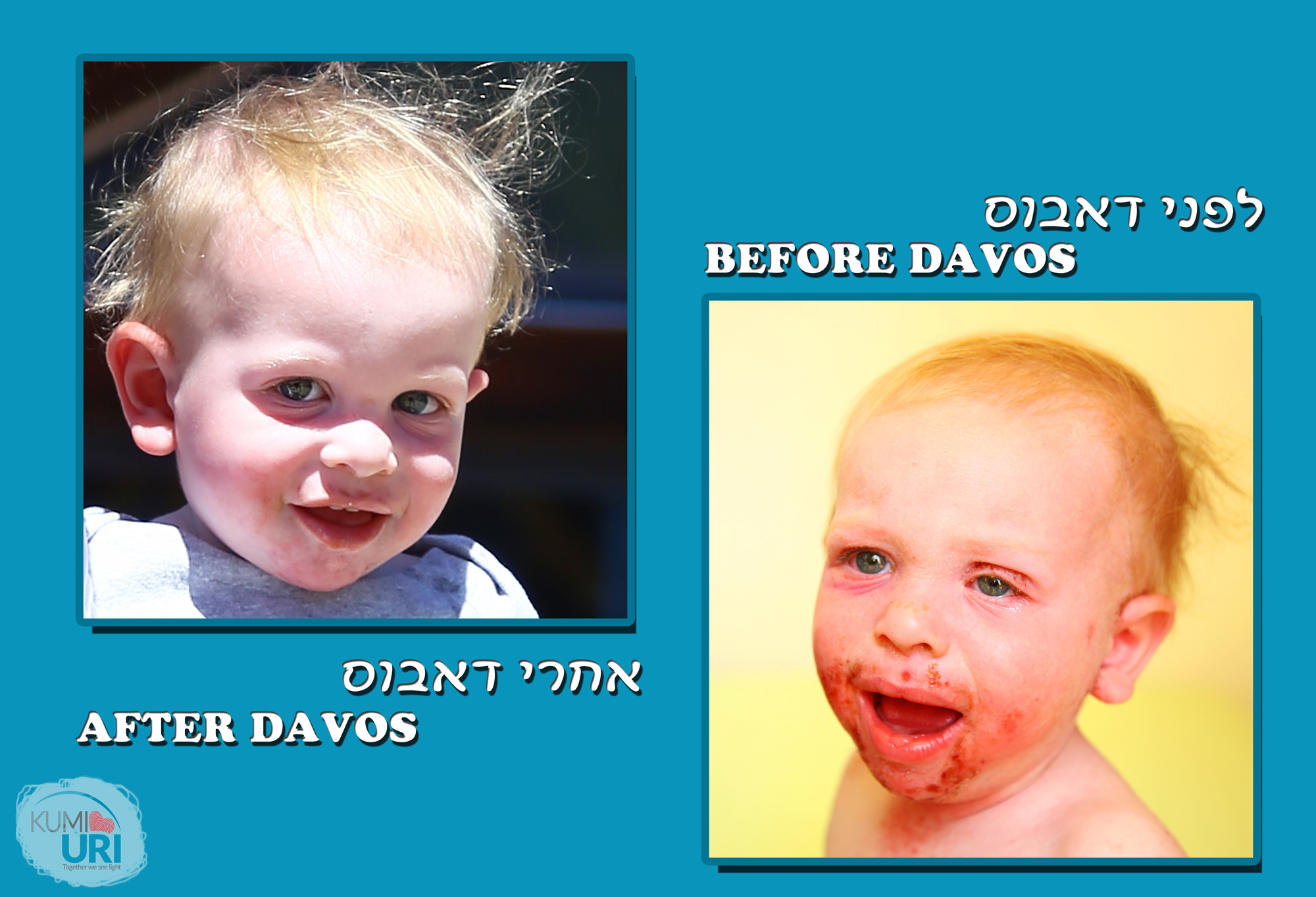 לפני ואחרי 2.jpg